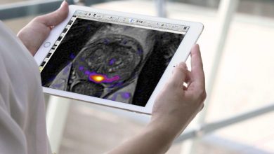 how-artificial-intelligence-can-help-your-prostate-gland
