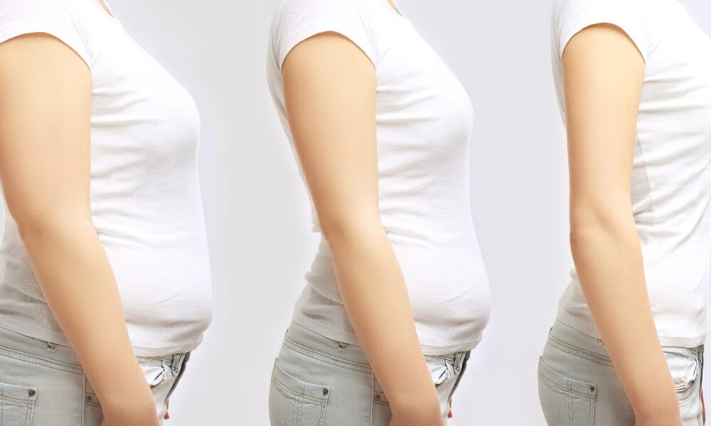 obesity-treatments-or-sports-—-what-matters-more-in-the-fight-against-weight-gain?